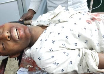 কাটোয়ায় চলন্ত ট্রেনে উঠতে গিয়ে কিশোরের দু’পায়ের ওপর দিয়ে চলে গেল ট্রেনের চাকা