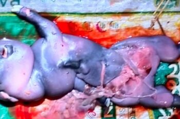 পূর্ব বর্ধমান জেলার ভাতারে মানব শিশুর আকৃতির ছাগল শাবকের জন্ম