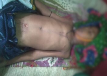 পূর্ব বর্ধমানে ফের বজ্রপাতে মৃত্যু হল কিশোরসহ ২ জনের, জখম ৪ শিশু