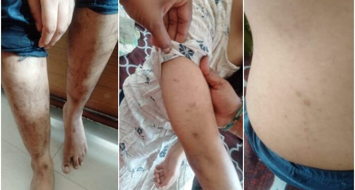 অপহরণের ৪ বছর পর উদ্ধার হল ‘লাভ জিহাদ’-এর শিকার হিন্দু তরুনী, অমানবিক অত্যাচারে ট্রমায় আক্রান্ত তরুনী শোনালেন ভয়ঙ্কর অভিজ্ঞতার কথা