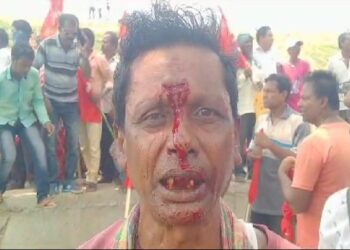 মনোনয়ন দাখিলে বাধা পেয়ে বামেরা প্রতিরোধে নামতেই রণক্ষেত্র বর্ধমানের বড়শুল, জখম বামফ্রন্ট প্রাথী সহ বেশ কয়েকজন কর্মী