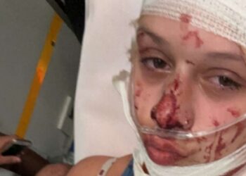 শরীর ঢাকা পোশাক না পরায় ফরাসি তরুণীর উপর প্রাণঘাতী হামলা চালালো মুসলিম অভিবাসীরা