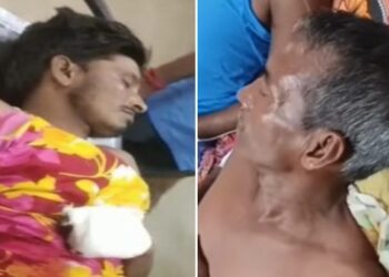 মুর্শিদাবাদের রানিনগরে কংগ্রেস- তৃণমূলের দেদার বোমাবাজি, বিস্ফোরণে উড়ল কংগ্রেস কর্মীর হাত-পা