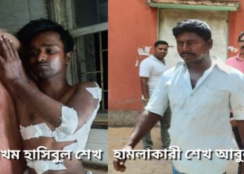 কাটোয়ায় ভাড়া নিয়ে বচসার জেরে টোটো চালককে ছুরি দিয়ে এলোপাথাড়ি কোপাল যাত্রী, গ্রেফতার অভিযুক্ত