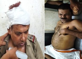 আউশগ্রামে খুনের মামলার তদন্তে গিয়ে আক্রান্ত পুলিশ, আহত আইসি ও এসআই