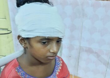 সফল অস্ত্রপচার করে কিশোরীর মাথায় গেঁথে যাওয়া কাঁচি বের করলেন কাটোয়া হাসপাতালের চিকিৎসকরা