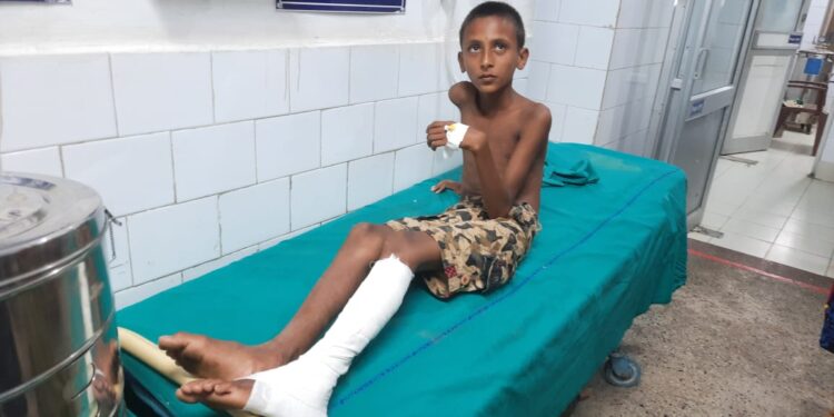 সিপিএম-তৃণমূলের বোমাবাজির মাঝে পড়ে গুরুতর জখম মুর্শিদাবাদের ষষ্ঠ শ্রেণীর ছাত্র