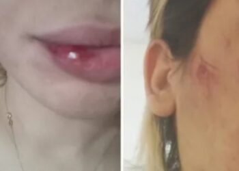 ইরানি মহিলা চিত্রশিল্পীকে নির্মমভাবে অত্যাচার