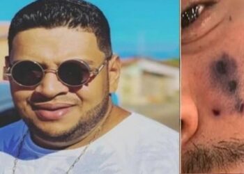 বিষাক্ত মাকড়সার কামড়ে মারা গেলেন ব্রাজিলের বিখ্যাত গায়ক