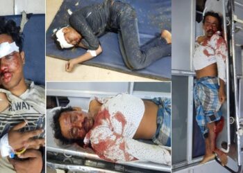 কাটোয়ায় বেপরোয়া বাইকের ধাক্কায় মৃত পথচারী, গুরুতর জখম দুই বাইক আরোহী