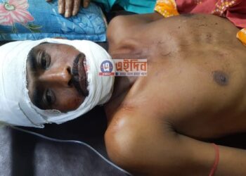 গলায় ফাঁস লাগিয়ে আত্মহত্যার চেষ্টা করেছিল স্বামী, কাস্তে দিয়ে ফাঁস কাটতে গিয়ে স্ত্রী কেটে ফেললেন স্বামীর গলা