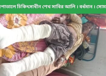 মঙ্গলকোটে বিক্ষুব্ধ তৃণমূল কর্মীকে পিটিয়ে দু’পা ভেঙে দিল ক্ষমতাসীন গোষ্ঠীর লোকজন