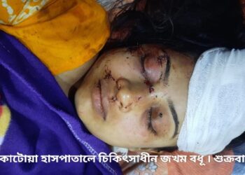 কাটোয়া-বর্ধমান রেললাইনের ধার থেকে রক্তাক্তবস্থায় উদ্ধার বধূ ও তার ৩ বছরের সন্তান