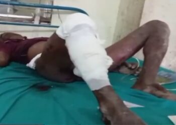 নদীয়া জেলার চাকদহে কৌটো বোমা বিস্ফোরণে আহত ৪ জন নির্মান শ্রমিক, আশঙ্কাজনক এক