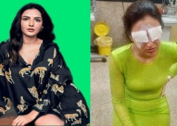 অভিনেত্রী জেসমিন ভাসিন চোখের লেন্স বিপর্যয়ে কর্নিয়াল ক্ষতির মুখে