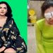 অভিনেত্রী জেসমিন ভাসিন চোখের লেন্স বিপর্যয়ে কর্নিয়াল ক্ষতির মুখে