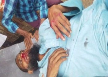 মন্তেশ্বরে সাইকেল-বাইক মুখোমুখি সংঘর্ষে গুরুতর আহত দুই চালক