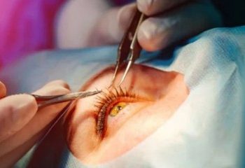 মেটিয়াবুরুজ সুপার স্পেশালিটি হাসপাতালে ছানি অস্ত্রপচারের পর ২৫ রোগীর চোখে সমস্যা ! রাজ্যের স্বাস্থ্য পরিষেবা নিয়ে প্রশ্ন তুললো বিজেপি