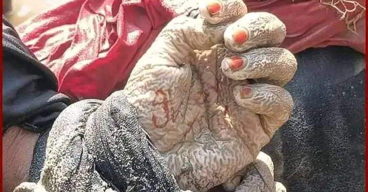 দু’হাত পিছনে বাঁধা, নখে লাল নেল পালিশ, বাম হাতের তালুতে মেহেদির রঙে লেখা ‘আই লাভ ইউ’, তিস্তা নদী থেকে উদ্ধার তরুনীর পচাগলা দেহ