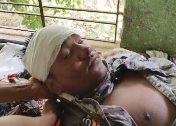 মন্তেশ্বরে দুই বাইকের সংঘর্ষে আহত ৩, গুরুতর আহত ১ বাইক আরোহী