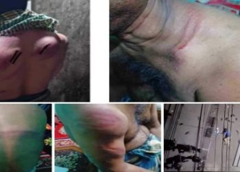 চট্টগ্রামে হিন্দুদের উপর বাংলাদেশের সেনার হামলা, বহু আহত, সিল করে দেওয়া হল হিন্দুদের দোকান, প্রমান লোপাটের জন্য ভাঙা হল সিসিটিভি ক্যামেরা