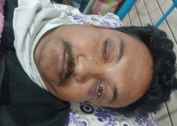 নিউ ফরাক্কা হাইস্কুলের প্রধান শিক্ষককে বেদম মারধরের অভিযোগ সহ শিক্ষকদের বিরুদ্ধে ; ভাঙল পা,ক্ষতিগ্রস্ত ডান চোখ