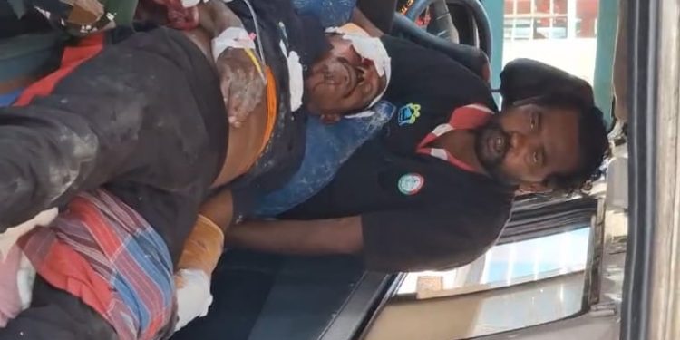 বাঘের মত হিংস্র জন্তুদের মোকাবিলায় ভরসা শুধু লাঠি,  অস্থায়ী বনকর্মীদের নিরাপত্তায় উঠছে গাফেলতির অভিযোগ  