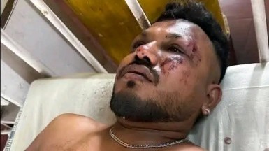 এয়ার ইন্ডিয়ার বিমান দুর্ঘটনায় অলৌকিকভাবে বেঁচে গেছেন এক ব্যক্তি