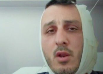 গ্রিসের সমুদ্র সৈকতে ঘুরতে যাওয়া ইসরায়েলি পর্যটকের কান কামড়ে ছিঁড়ে নিল সিরীয় জঙ্গি