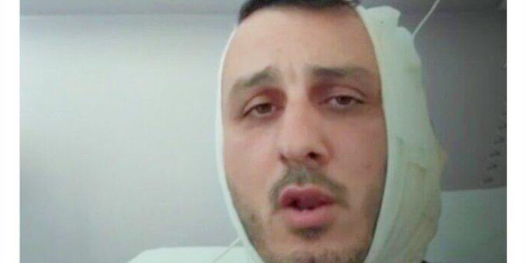 গ্রিসের সমুদ্র সৈকতে ঘুরতে যাওয়া ইসরায়েলি পর্যটকের কান কামড়ে ছিঁড়ে নিল সিরীয় জঙ্গি