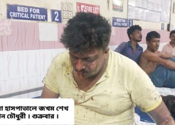 কাটোয়ায় বোমা বাঁধতে গিয়ে বিস্ফোরণে মৃত ১, গুরুতর আহত ১, গুঁড়িয়ে গেল মাটির বাড়ি