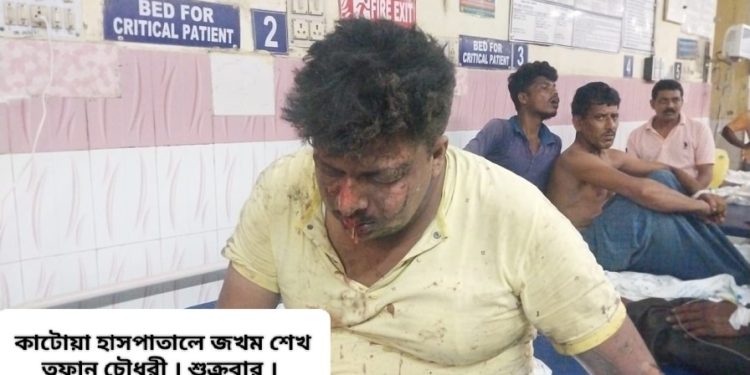কাটোয়ায় বোমা বাঁধতে গিয়ে বিস্ফোরণে মৃত ১, গুরুতর আহত ১, গুঁড়িয়ে গেল মাটির বাড়ি