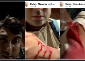 কলকাতার পার্ক সার্কাসে আক্রান্ত রিপাবলিক বাংলার সাংবাদিক কিশলয় মুখার্জী, নিন্দায় সরব বিজেপি