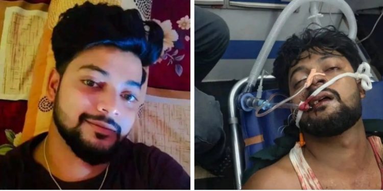 দুর্ঘটনায় গুরুতর আহত ভাতারের বামশোর গ্রামের দরিদ্র পরিবারের যুবক, চিকিৎসার খরচের জন্য কাতর আবেদন ফেসবুকে