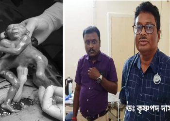 এক মাথা-চার হাত ও চার পা বিশিষ্ট অদ্ভুতদর্শন শিশুর জন্ম ভাতারের বেসরকারি হাসপাতালে