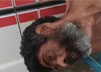 নদীয়া : ৫ দিন ধরে হাসপাতালের বহির্বিভাগের সামনে বিনা চিকিৎসায় কাতড়াচ্ছে এইচআইভি পজিটিভ বৃদ্ধ, খোঁজ নেই পরিবারের