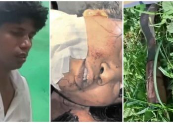 ফের বিতর্কে সিভিক ভলান্টিয়ার, প্রেমের প্রস্তাব ফেরানোয় তরুনীকে ধারালো অস্ত্র দিয়ে কুপিয়ে আত্মহত্যার চেষ্টা, দিদিকে বাঁচাতে গিয়ে আক্রান্ত ভাই