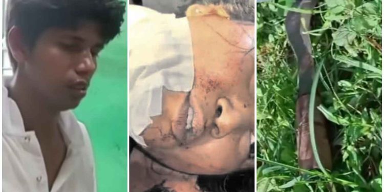 ফের বিতর্কে সিভিক ভলান্টিয়ার, প্রেমের প্রস্তাব ফেরানোয় তরুনীকে ধারালো অস্ত্র দিয়ে কুপিয়ে আত্মহত্যার চেষ্টা, দিদিকে বাঁচাতে গিয়ে আক্রান্ত ভাই