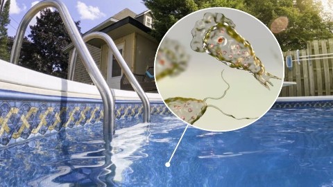 “মস্তিষ্ক-খেকো” অ্যামিবার সংক্রমণে কেরালায় ১৯ জনের মৃত্যু, নাক দিয়ে  মাথায় ঢুকে পড়ে ওই পরজীবি 