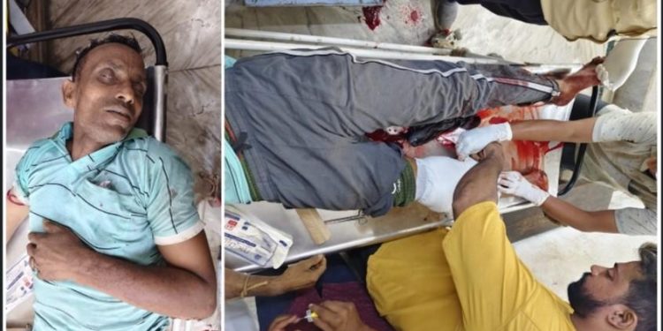 বন্ধ দোকানের কার্বাইড গ্যাসের সিলিন্ডারের বিস্ফোরণে ছিটকে আসা ধাতব টুকরোয় গুরুতর আহত টোটোচালক 