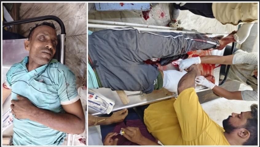 বন্ধ দোকানের কার্বাইড গ্যাসের সিলিন্ডারের বিস্ফোরণে ছিটকে আসা ধাতব টুকরোয় গুরুতর আহত টোটোচালক 