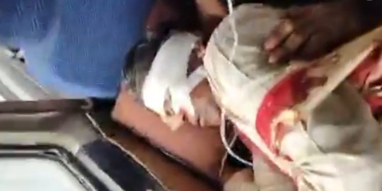 নাগরাকাটায় ত্রাণ দিতে যাওয়া  বিজেপি সাংসদ খগেন মুর্মু ও বিধায়ক শঙ্কর ঘোষের উপর তৃণমূল আশ্রিত দুষ্কৃতীদের প্রাণঘাতী হামলা, রক্তাক্ত সাংসদ হাসপাতালে চিকিৎসাধীন 