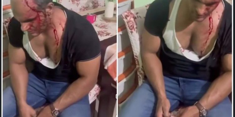 সোনারপুরে শুল্ক অফিসারের ফ্লাটে ঢুকে হামলার অভিযোগ, ‘হামলায় মূল অভিযুক্ত আজিজুল গাজী শাসক দলের ঘনিষ্ঠ’ বলে দাবি বিজেপির 