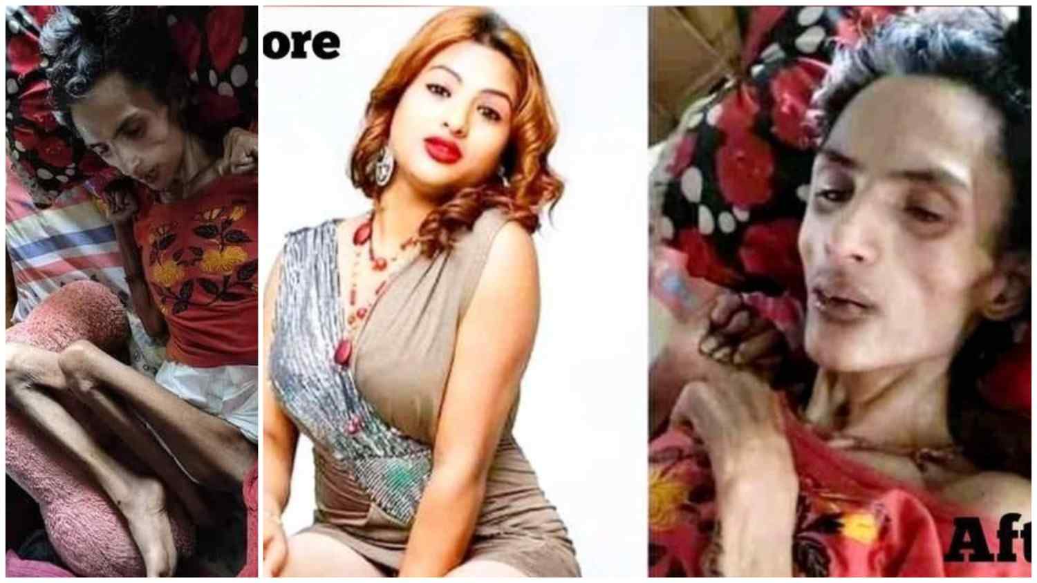 মেকি মানবতাবাদীদের নিদারুন অবহেলার শিকার নেপালি সুন্দরী অভিনেত্রী নিশা ঘিমিরের করুন কাহিনী 