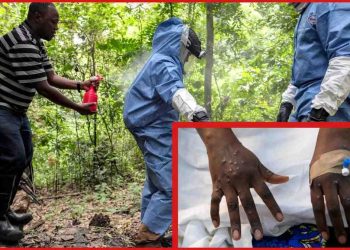 ইবোলার থেকেও ভয়ঙ্কর নতুন ভাইরাসের প্রাদুর্ভাব, ইথিওপিয়ায়  আক্রান্ত ৯, বাদুড় থেকে ছড়ায় এই ভাইরাস 