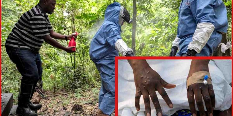 ইবোলার থেকেও ভয়ঙ্কর নতুন ভাইরাসের প্রাদুর্ভাব, ইথিওপিয়ায় আক্রান্ত ৯, বাদুড় থেকে ছড়ায় এই ভাইরাস