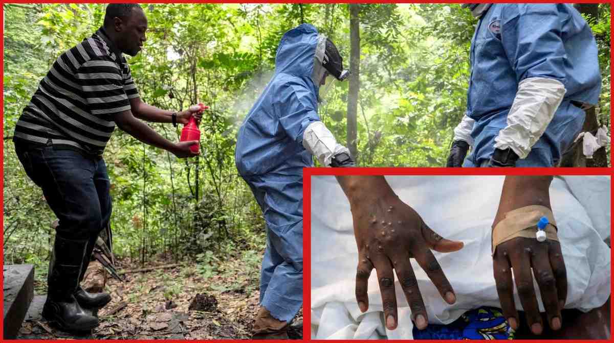 ইবোলার থেকেও ভয়ঙ্কর নতুন ভাইরাসের প্রাদুর্ভাব, ইথিওপিয়ায় আক্রান্ত ৯, বাদুড় থেকে ছড়ায় এই ভাইরাস
