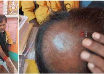 কাটোয়ায় ফর্ম ৭ জমা দিতে যাওয়া বিজেপির উপর তৃণমূলের হামলা, আহত বেশ কয়েকজন 