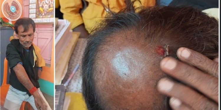 কাটোয়ায় ফর্ম ৭ জমা দিতে যাওয়া বিজেপির উপর তৃণমূলের হামলা, আহত বেশ কয়েকজন 