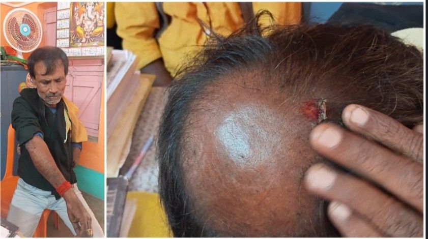 কাটোয়ায় ফর্ম ৭ জমা দিতে যাওয়া বিজেপির উপর তৃণমূলের হামলা, আহত বেশ কয়েকজন 